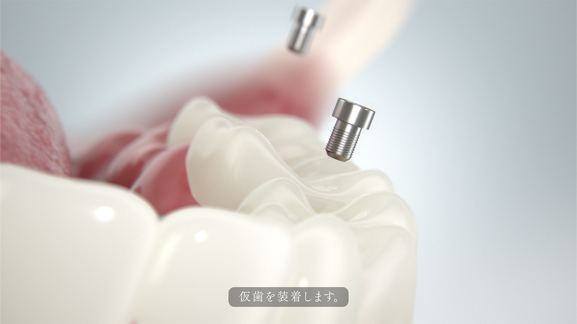 ADCの画像5